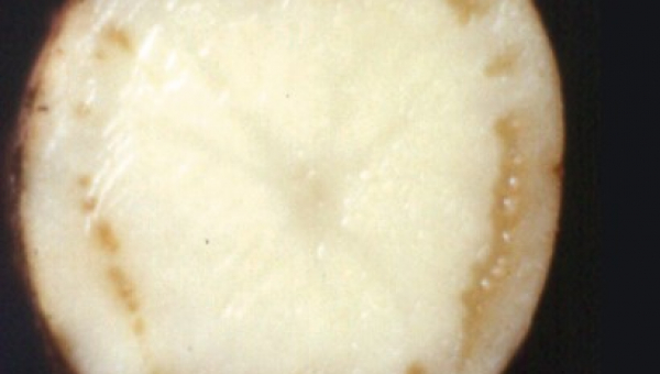 ΔΑΚΤΥΛΙΩΤΗ ΣΗΨΗ